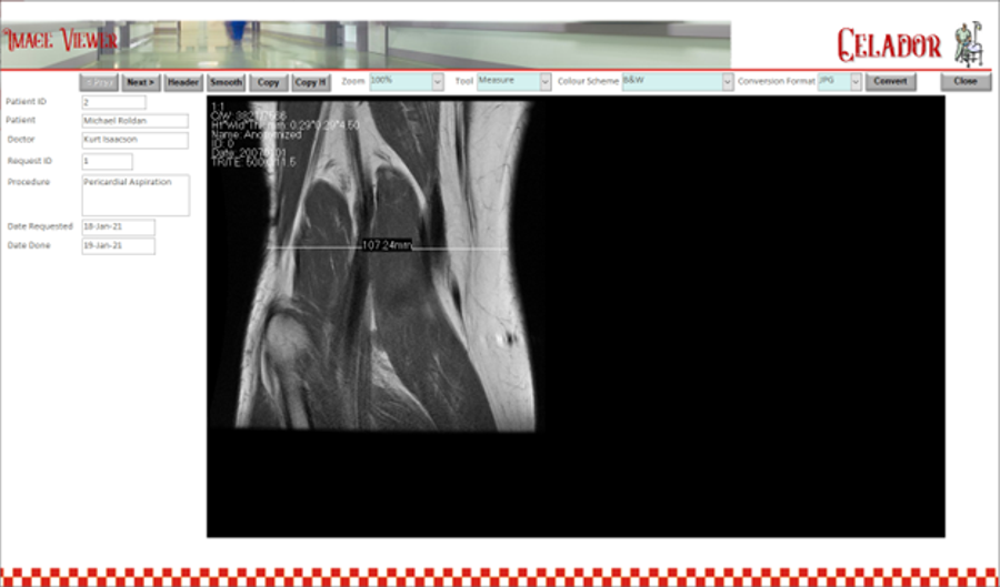 Image Viewer Screen